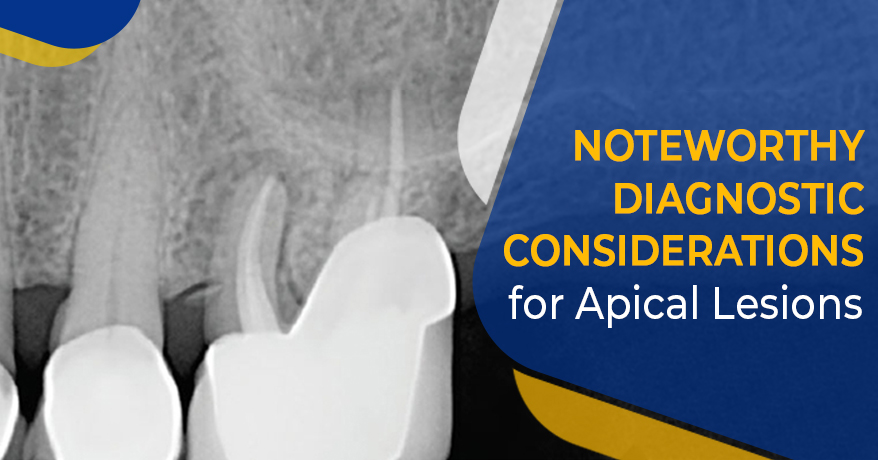 Noteworthy Diagnostic Considerations for Apical Lesions